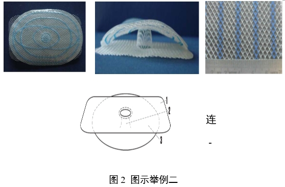 疝修補補片注冊審查指導原則(2023年修訂版)(2023年第9號)(圖5) 疝修補補片注冊審查指導原則(2023年修訂版)(2023年第9號)(圖5)