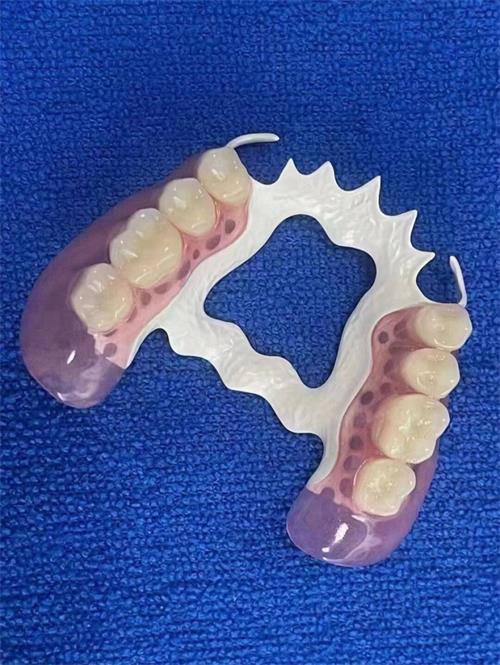 常見的義齒有哪些(圖2) 常見的義齒有哪些(圖2)